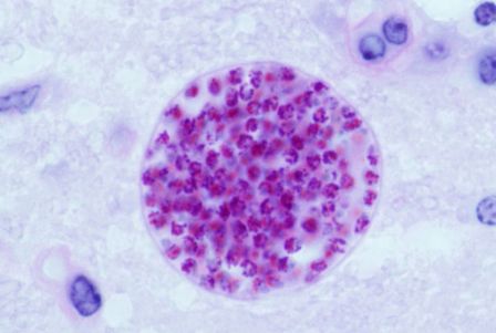 Toxoplasma gondii cyst in a mouse brain